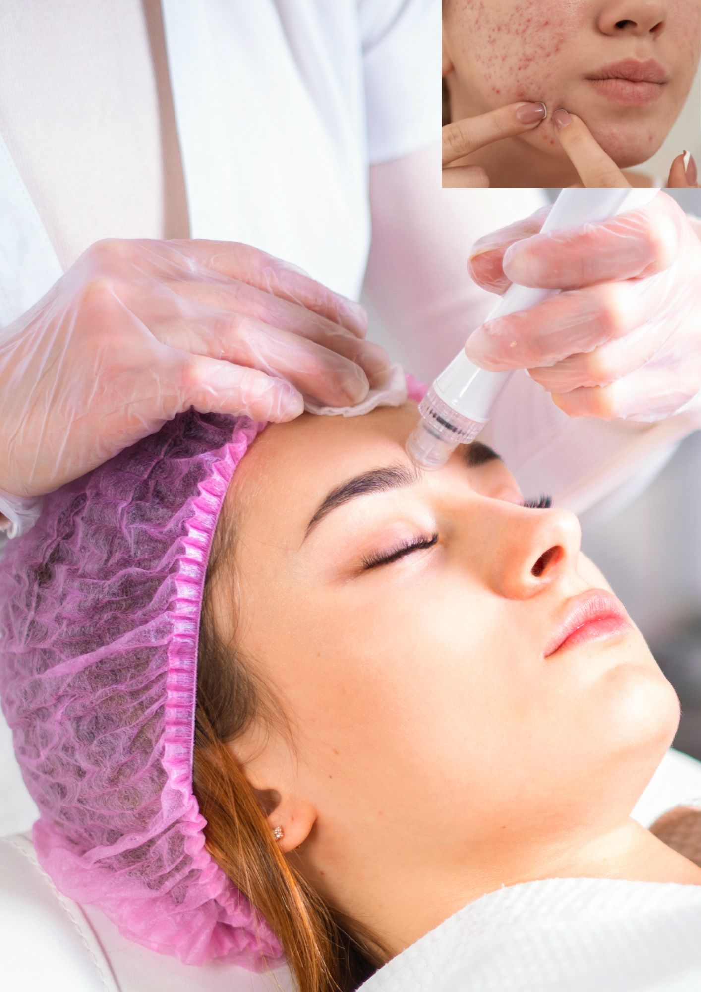 Aqua Facial CURE TEENIE