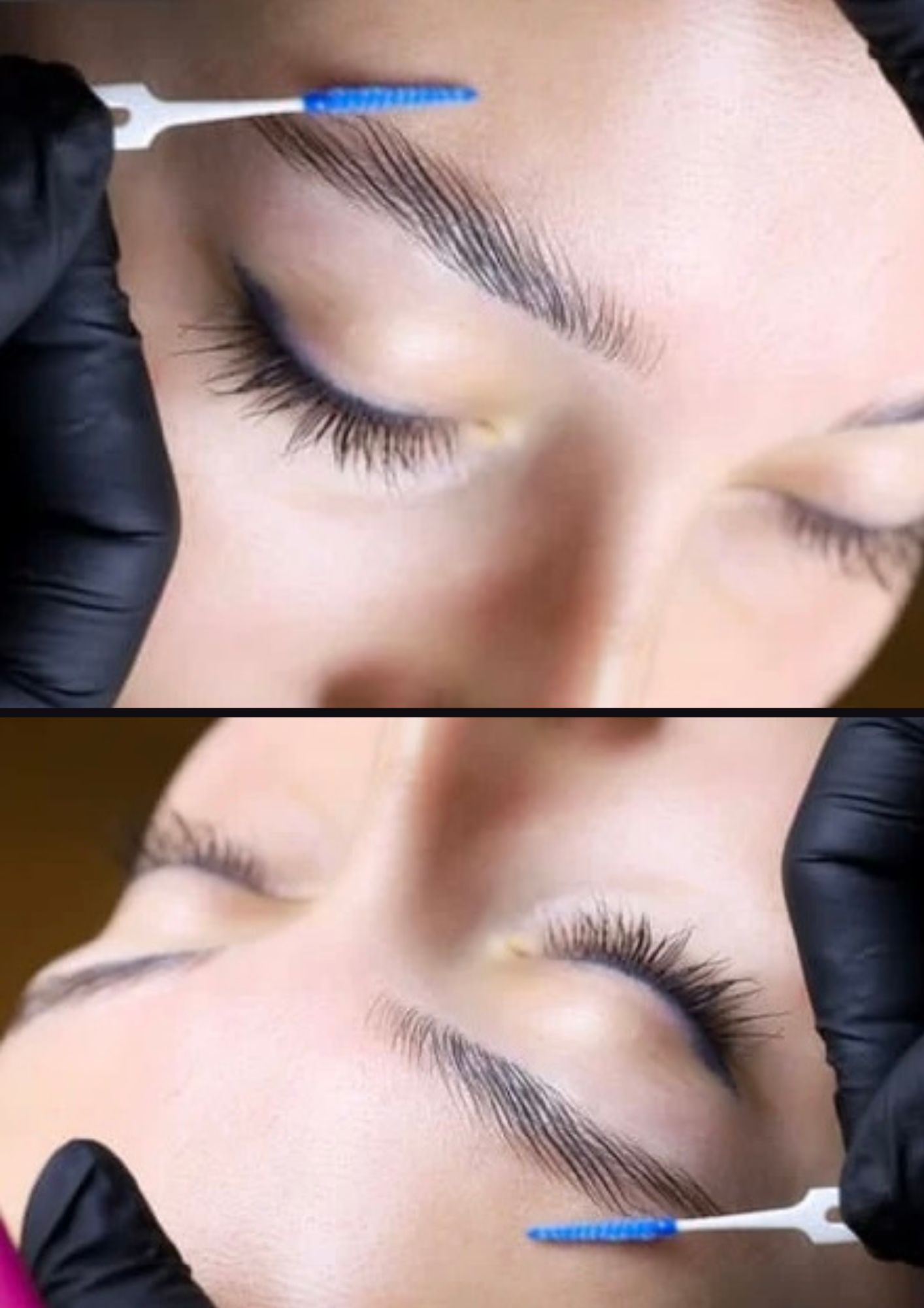 Augenbrauenlifting / Browlifting